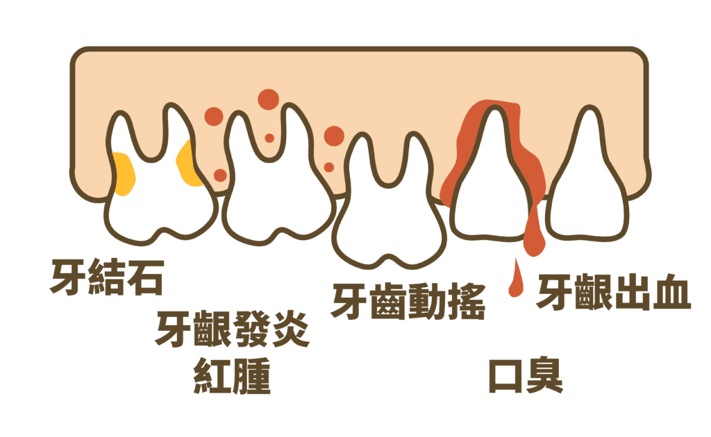 牙周統合簡介 - 欣揚牙醫