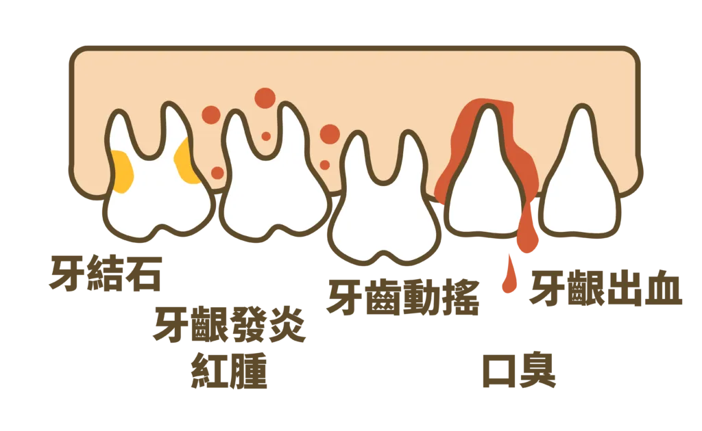 牙周統合簡介 - 欣揚牙醫